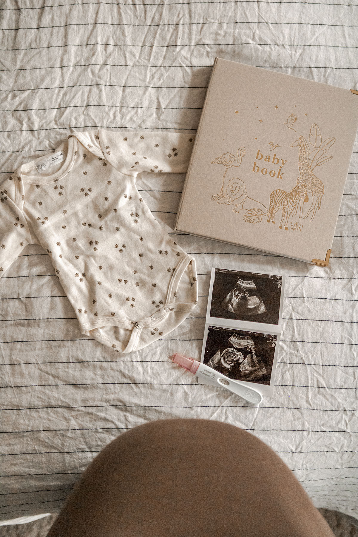 coping with pregnancy after loss 20 weeks pregnant