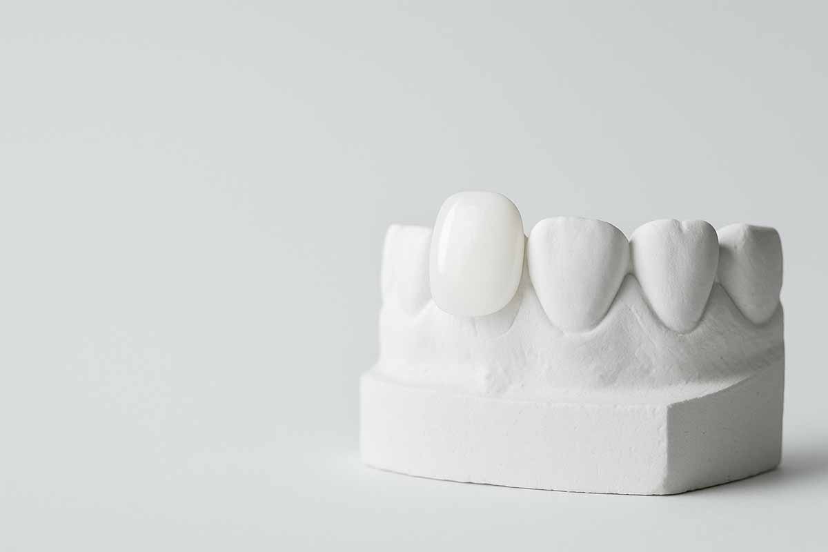 Enhancing Your Smile With Practical Tips For Confidence.